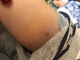 Появилось круглое пятнышко