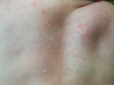 Кажется это аллергия, врач