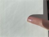 Псориаз ногтей при ГВ