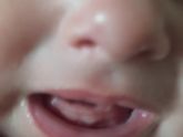 Зубы