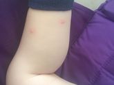 Это аллергия ??? Или что ???