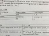 Потеряшка