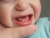 В течение какого времени зуб выходит на полную высоту?