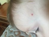 Что это такое? На тельце больше ни где не обнаружила