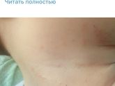 Аллергия или что?