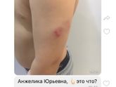 Конфликт мамаши в д.саду