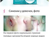 Синехии у кого было отзовитесь