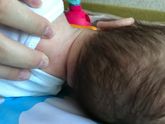 Аллергия? Или цветение?