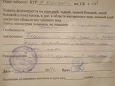 Хорион по двум стенкам