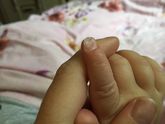 Вмятинки на ногтях..