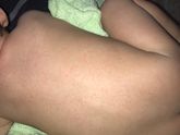 Аллергия или что-то другое?