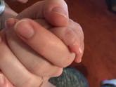 К какому врачу обращаться