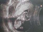 Мальчик 🤰💙