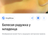 Белесая радужка глаза