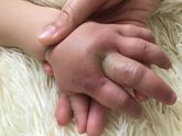 Девочки что делать??? Помогите