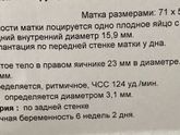 Первое узи ?