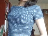 18 недель. Плановый осмотр.