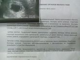Первое УЗИ, 6 недель.