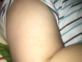 Аллергия?