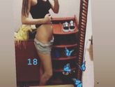 18 отеки , обморок , ташнота