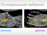 Девочки с Нальчика