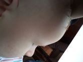 Сыпь на какую еду?