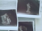 Осмотр врача в роддоме