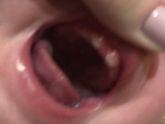 Зубы