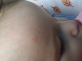 Что за пятна. Кто знает?