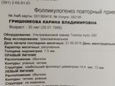 Фоликулогинез 12дц