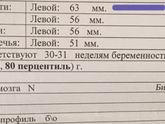 3скрининг