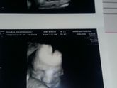 4 мес. Не врачей прошу пройти мимо, ваше мнение о весе мне не интересно.