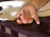 Девочки, у малышки покраснел