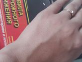 Кровь с кисти руки???