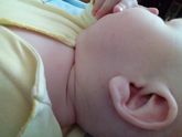 Что это за прыщики кто знает?