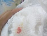 Так кто сталкивался с розовыми выделениями у девочек новорожденных зайдите.