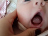 Молочница во рту у младенца (!!