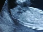 Пол по фото узи