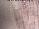 Борьба с растяжками. 2 шлифовка