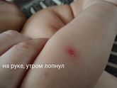 Появились пузырьки, на вид