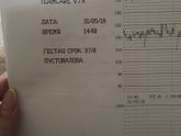 Кто-то разбирается в ктг?