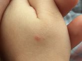 У дочки соскочил какой
