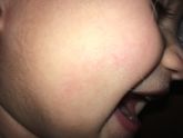 Капилляры ?