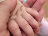 Девочки, чем мазать, обрабатывать???