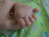 Как легко подстричь ногти на ногах