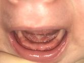 Зубы ?