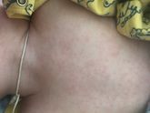 РОЗЕОЛА! Прошлый пост с фото видели?