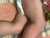 Идти к педиатру с утра? Аллергия