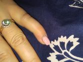 Стоит ти ехать в травму или само пройдет???