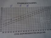 Подозрение на многоводие